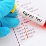 Full thyroid blood test | t4 and t3 blood test – Anna Pharmacy